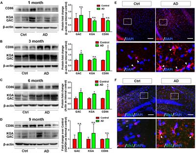 Glutaminase C Regulates Microglial Activation and Pro-inflammatory Exosome Release: Relevance to the Pathogenesis of Alzheimer’s Disease